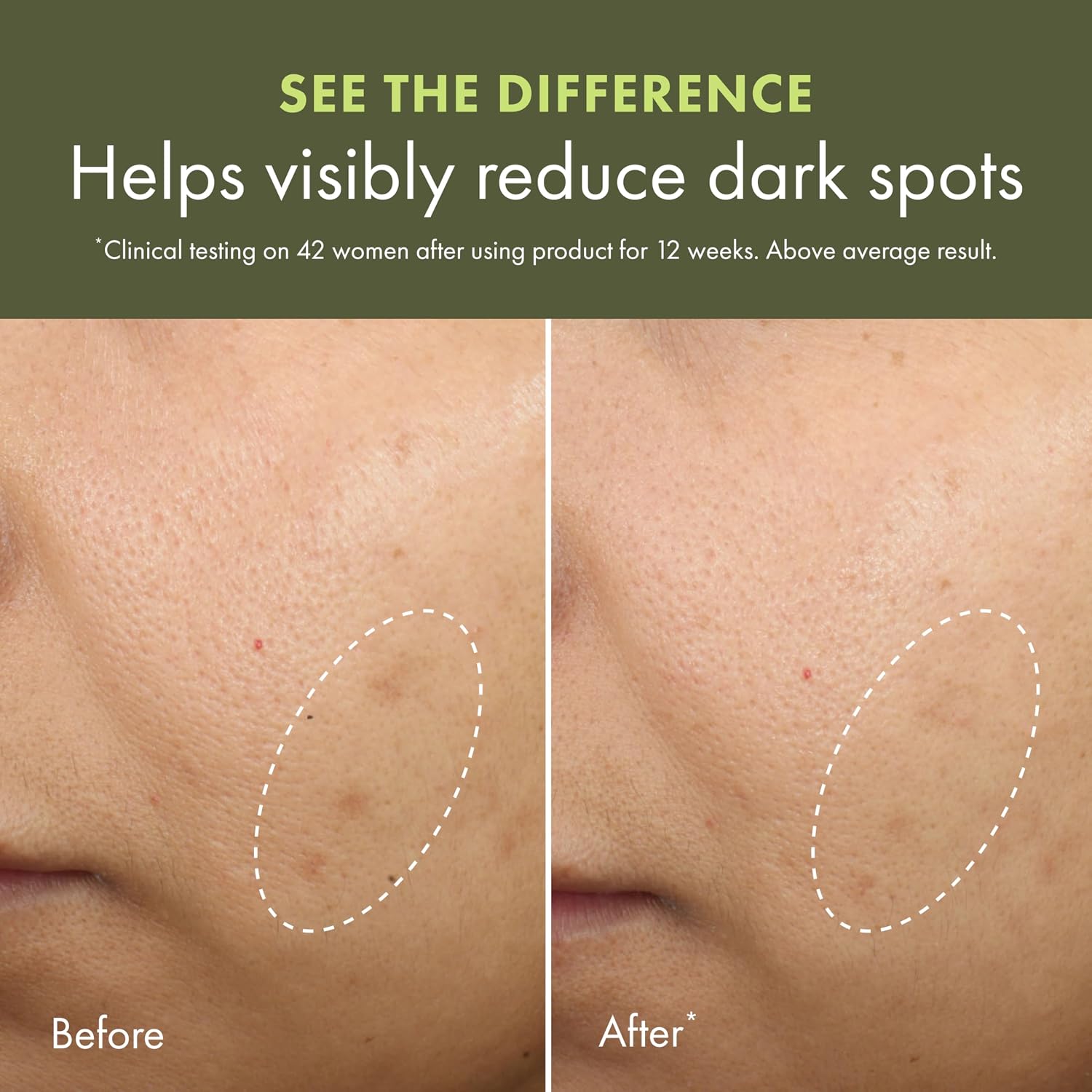 Mega-Mushroom Dark Spot Corrector Moisturizer image 2
