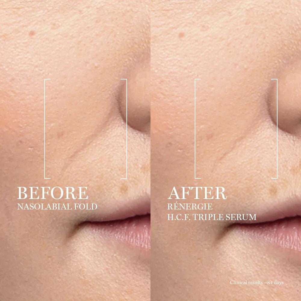 Renergie Ultra Triple Serum  image 2